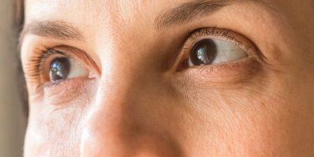 Study Links a Type of Eye Lesions to Heart Disease Risk