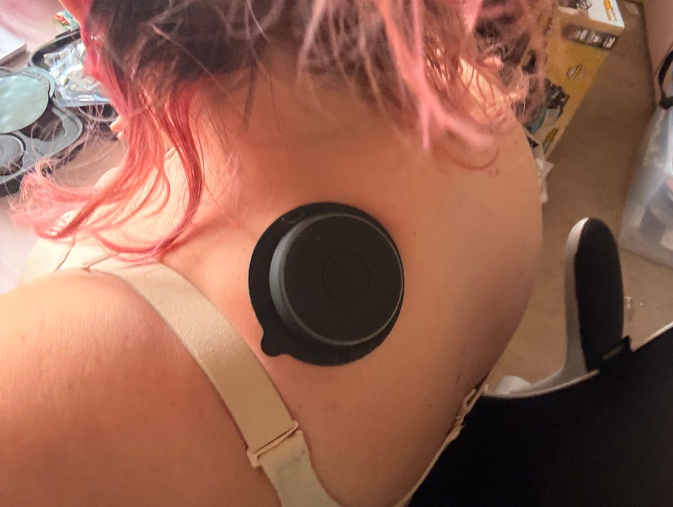 back of a person with a round object attached to their shoulder