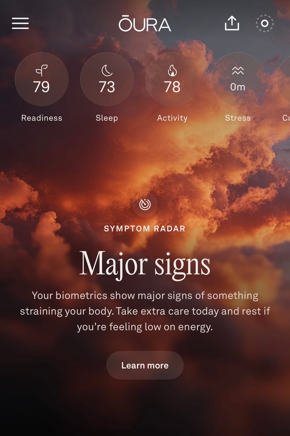 Oura health tracking app interface displaying readiness, sleep, activity, and stress levels.