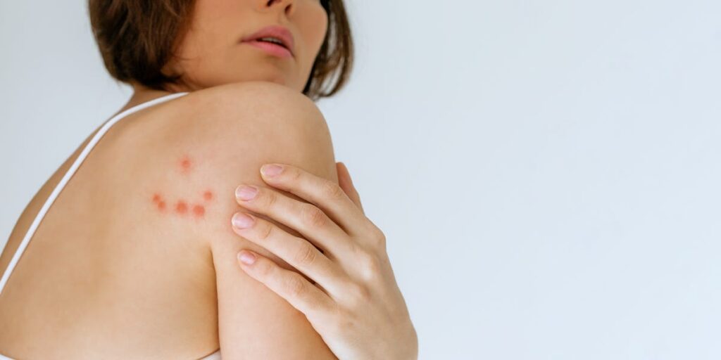 Pest Experts Share How to Get Rid of Bed Bugs at Home