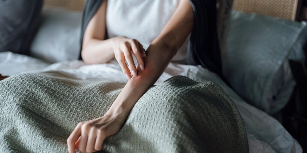 The Best Treatments for Itchy Skin, According to Dermatologists