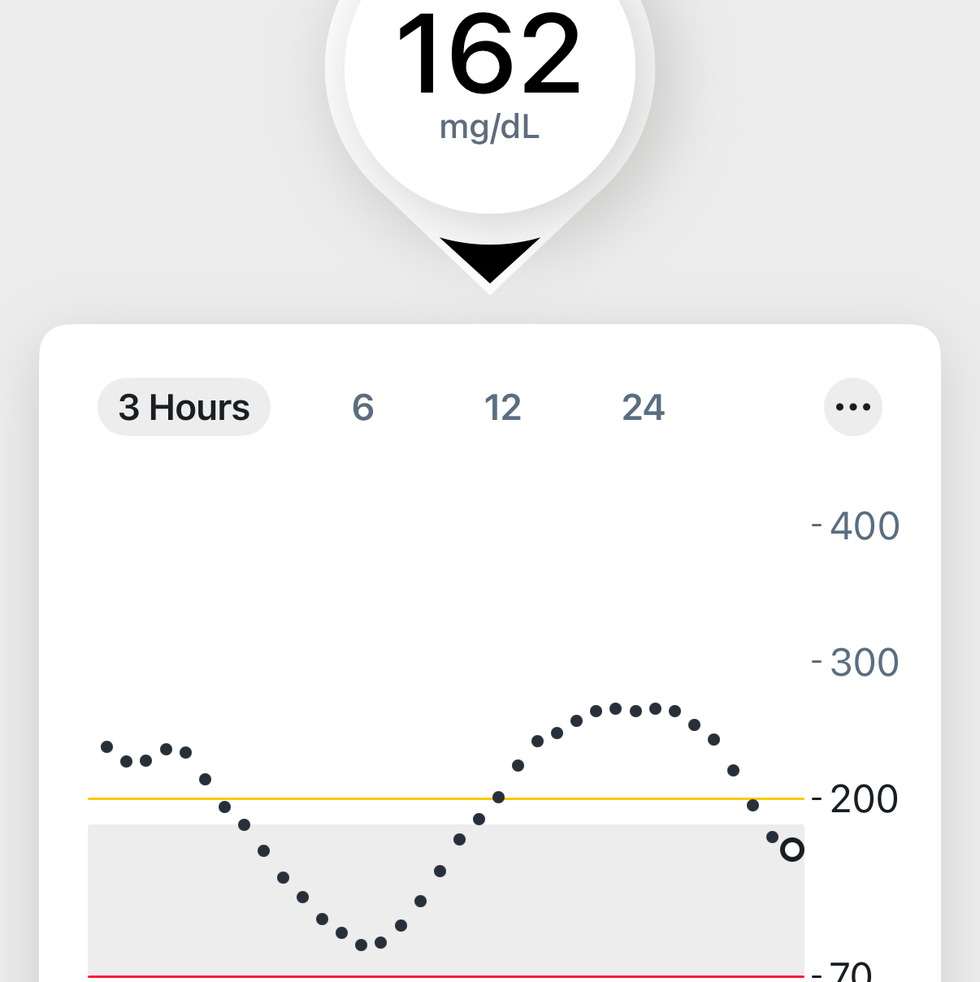 continuous glucose monitor blood sugar graph with levels dropping