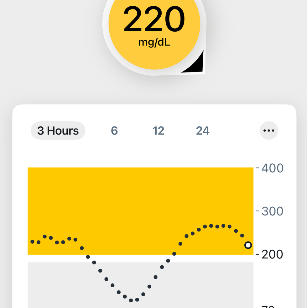 continuous glucose monitor blood sugar graph