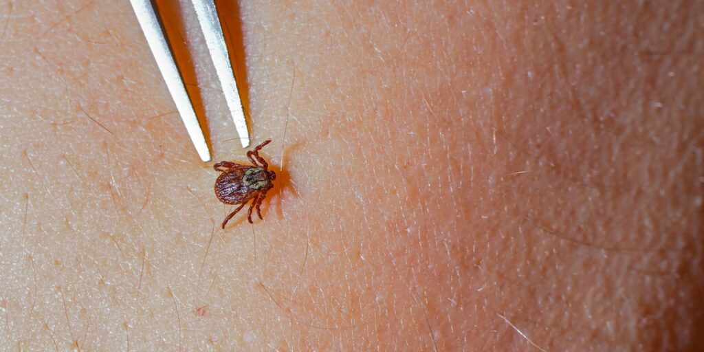 What Does a Tick Bite Look Like?