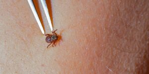 What Does a Tick Bite Look Like?