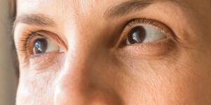 Study Links a Type of Eye Lesions to Heart Disease Risk
