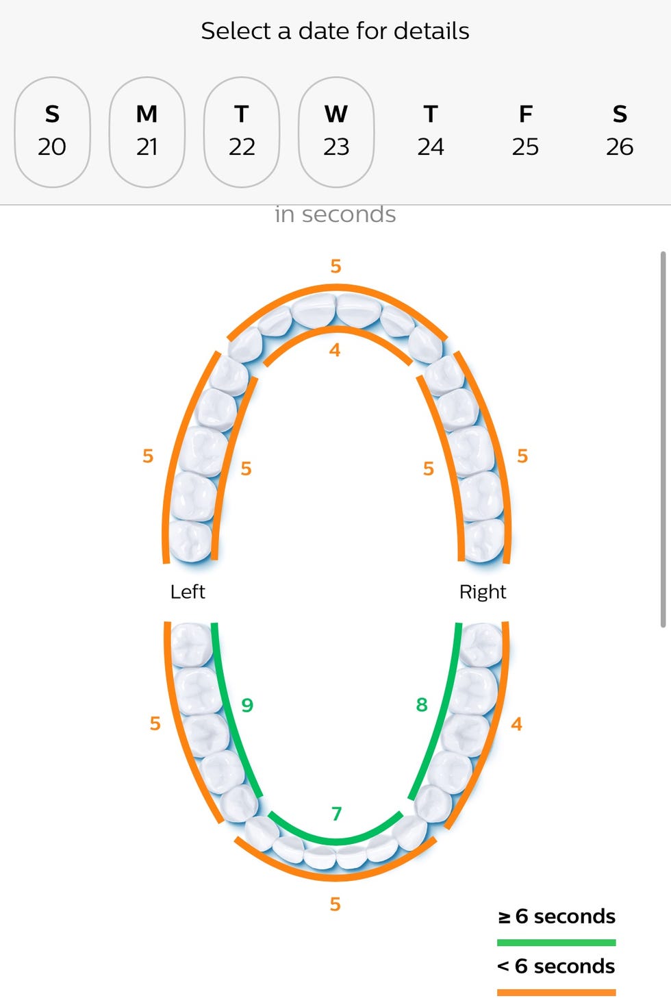 Graphical representation of tooth positions and time intervals for dental treatment tracking from September 20 to 26, 2026.