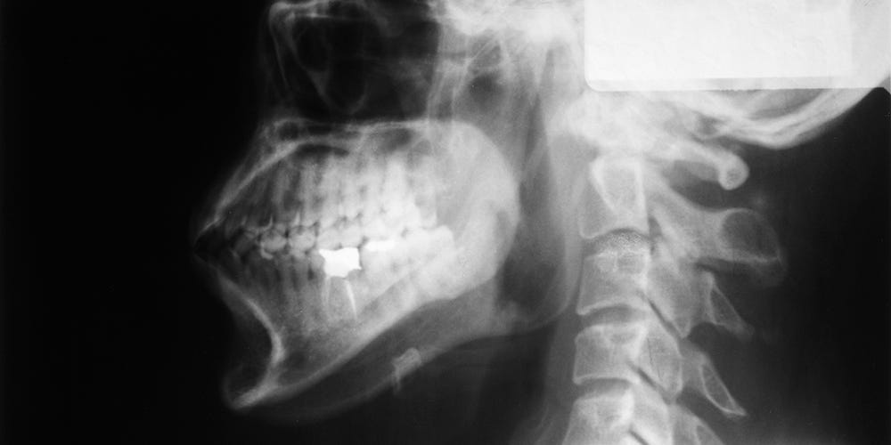 I Was Misdiagnosed With An Allergy And Panic Attacks Until An X-Ray Finally Revealed The Real Problem